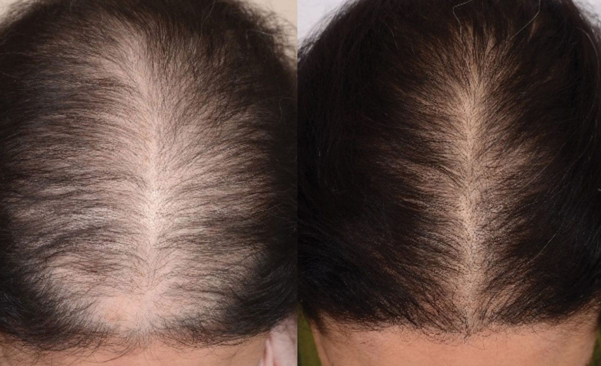 "The Natural Scalp and Hair Kit made my hair grow back thicker in just 6 weeks!" - Nirwal M.